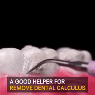 Electric Dental Calculus Remover - Wholesalus