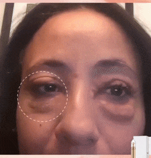 Instant Eye Bag Removal - Wholesalus
