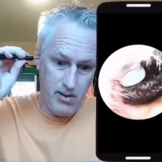 Wireless Endoscope HD Ear Pick Set - Wholesalus
