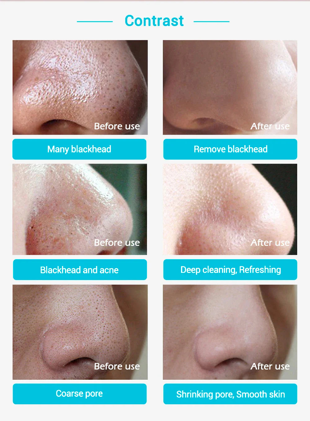 Nose Pore Strip Blackhead Remover - Wholesalus