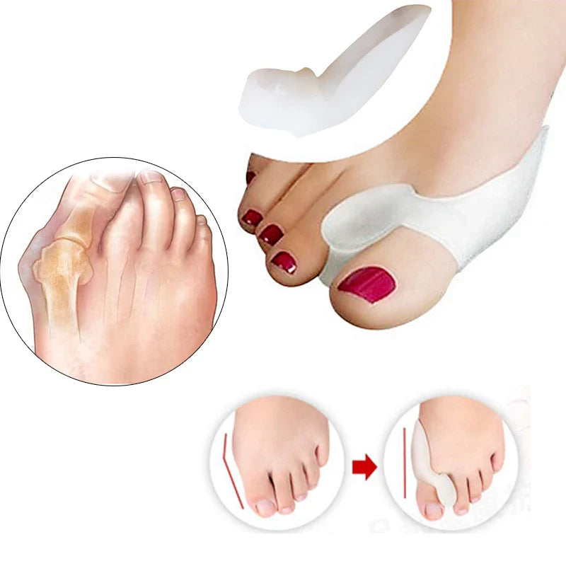 Silicone Toes Valgus Corrector - Wholesalus