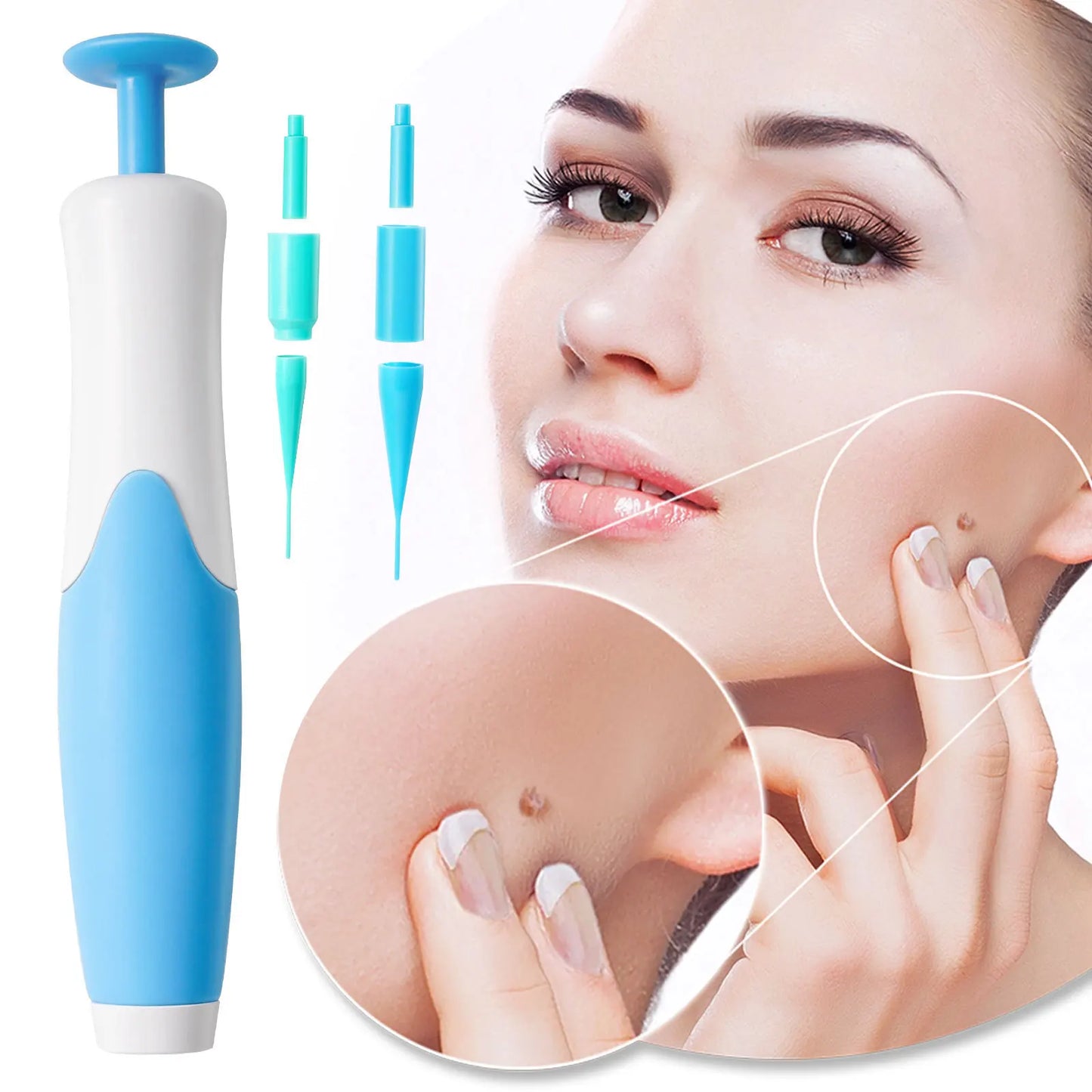 Skin Tag Removal Kit - Wholesalus