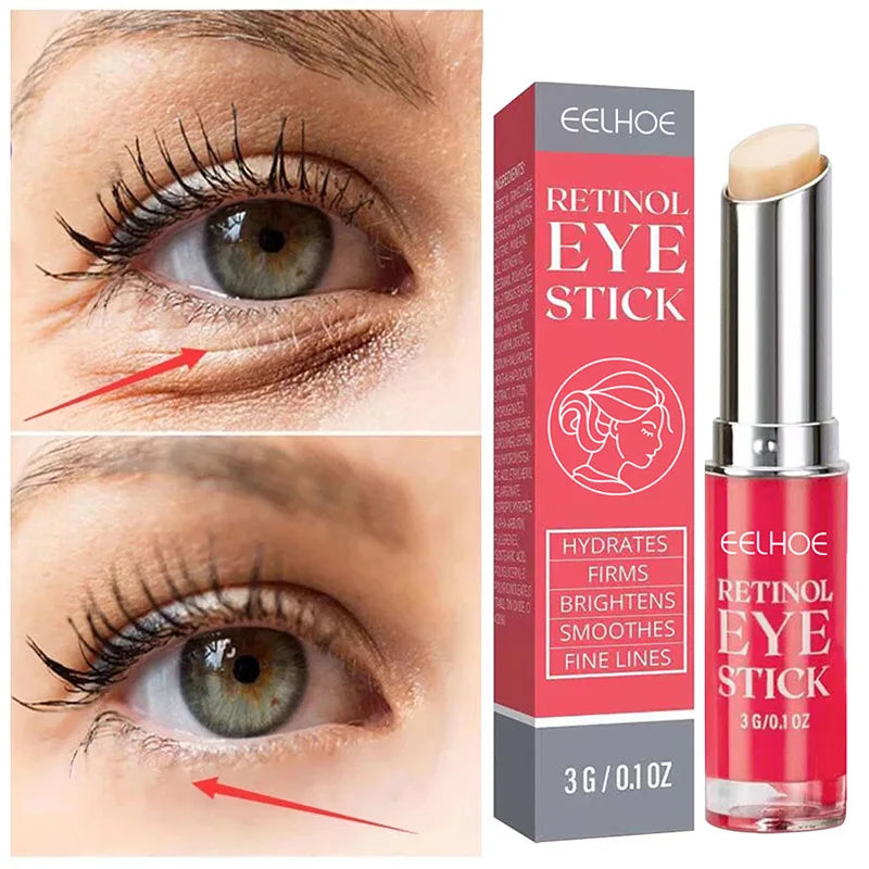 Anti Wrinkle Eye Bag Remover Cream