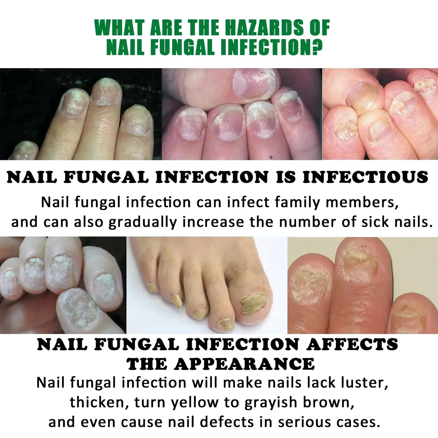 Nail Fungus Defender Serum - Wholesalus