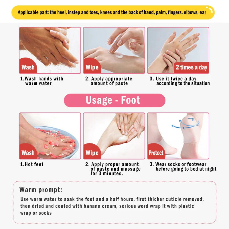 Dead Skin Remover Crack Cream - Wholesalus