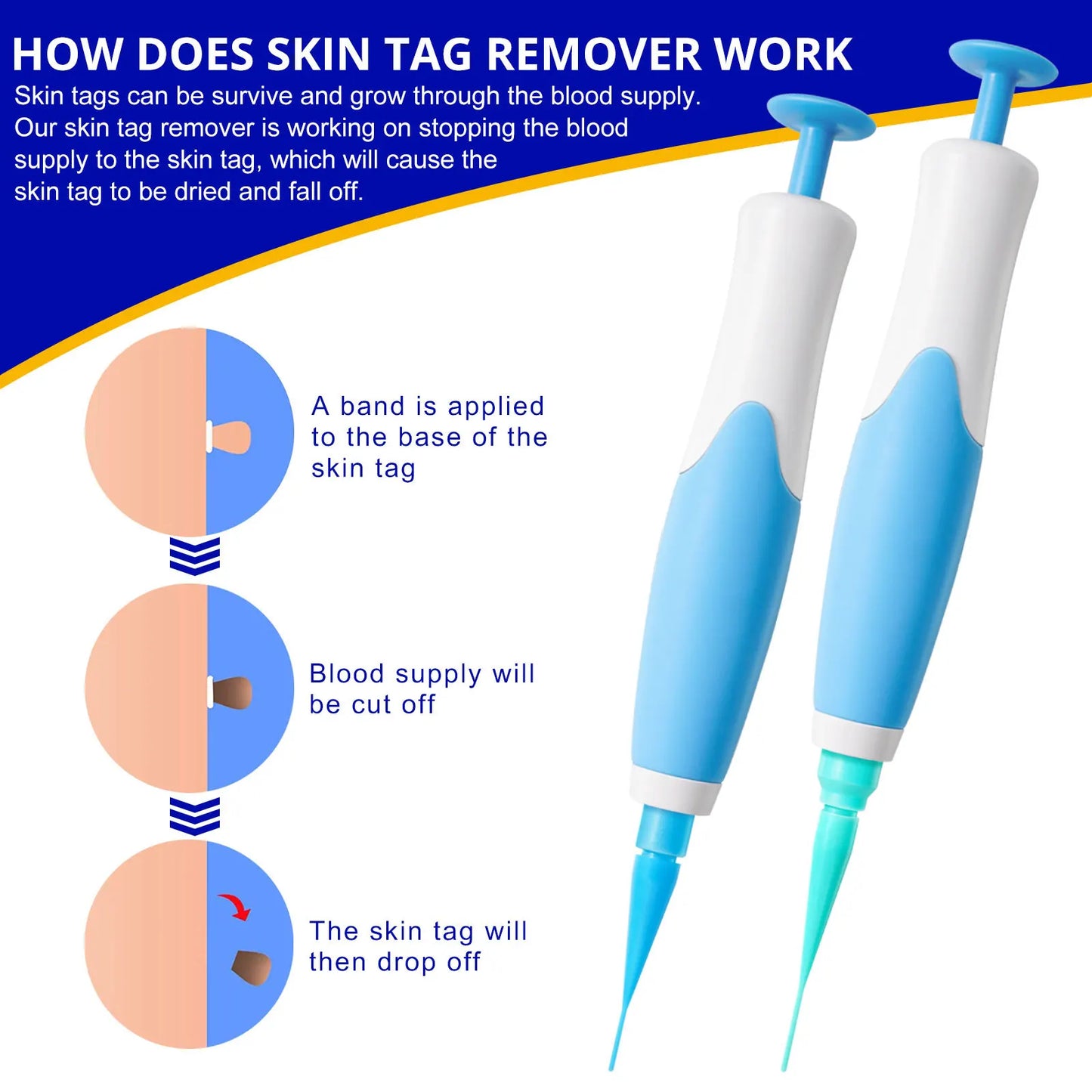 Skin Tag Removal Kit - Wholesalus