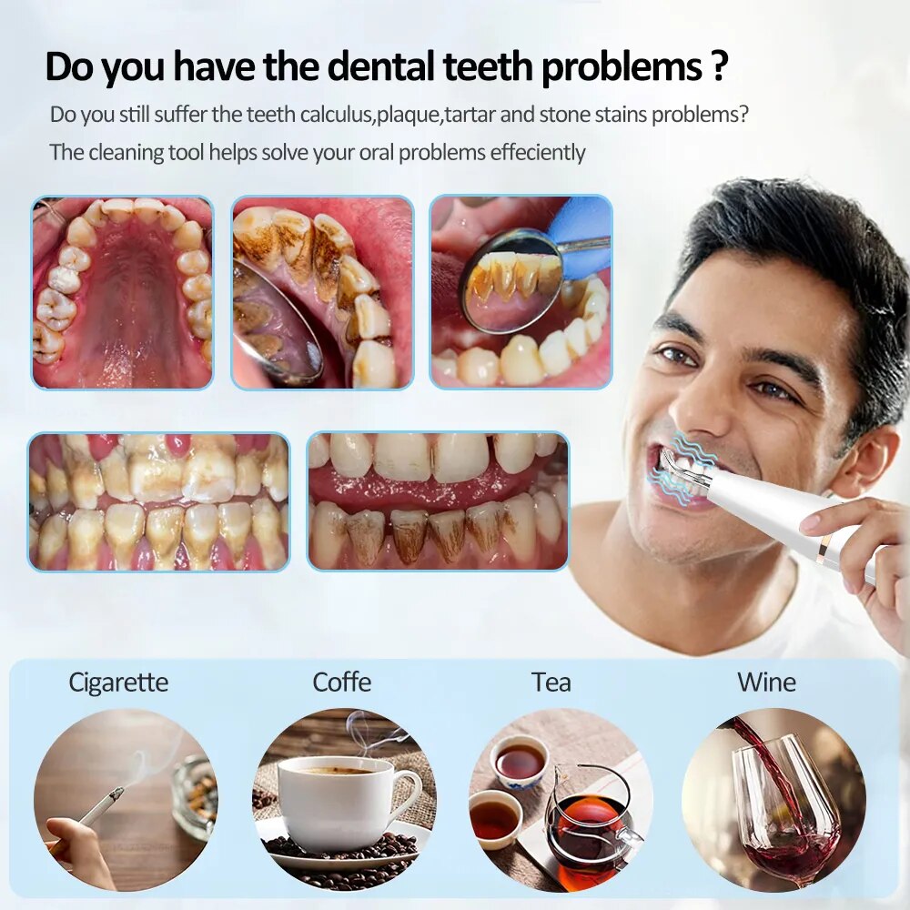 Electric Dental Calculus Remover - Wholesalus