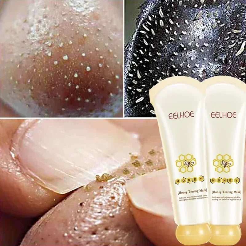 Dead Skin Removal Peel-off Mask - Wholesalus