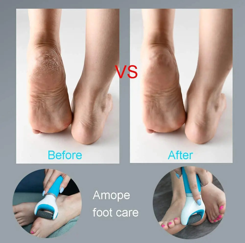 USB Foot Callus Remover Pedicure Tool - Wholesalus