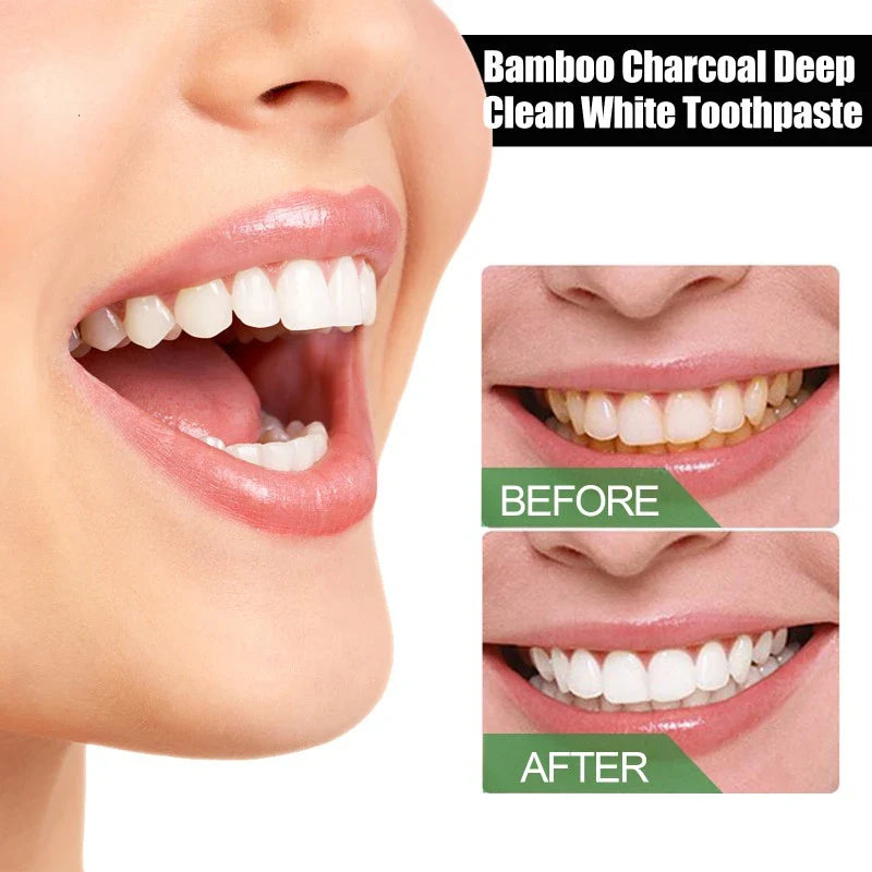 Bamboo Charcoal Teeth Whitening Toothpaste - Wholesalus