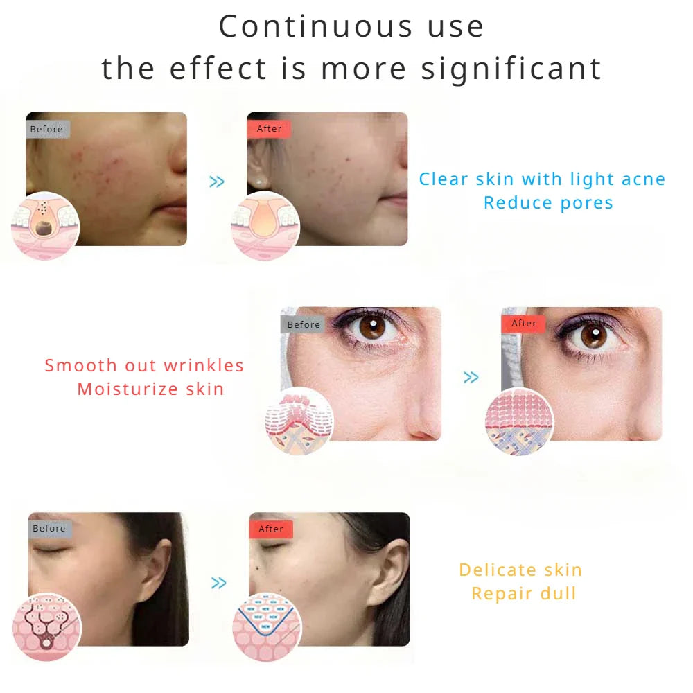 LED Red Light Therapy Facial Mask - Wholesalus