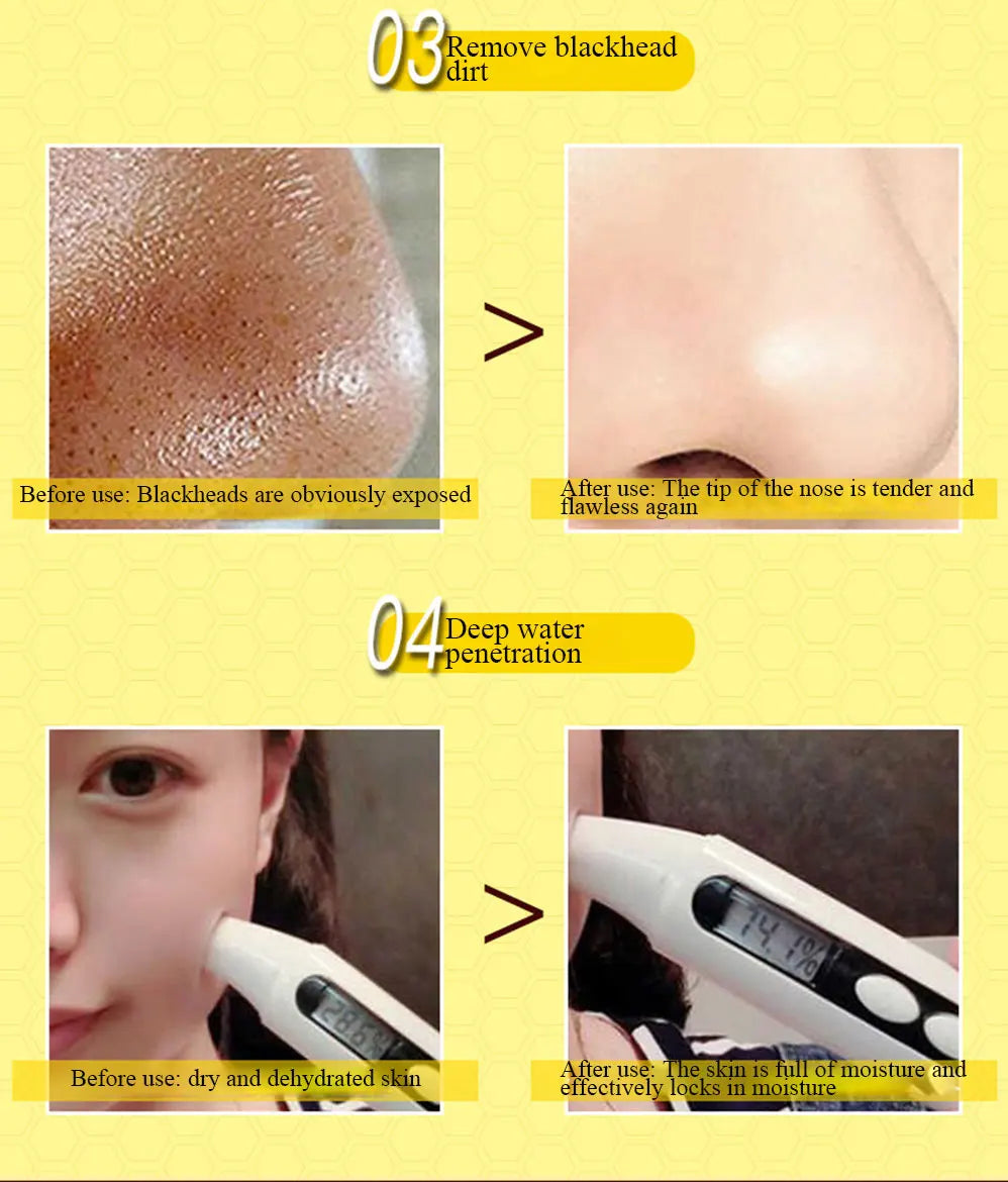 Dead Skin Removal Peel-off Mask - Wholesalus
