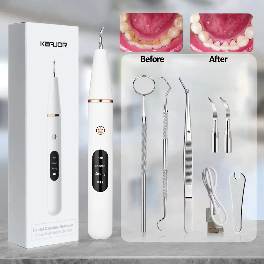 Electric Dental Calculus Remover - Wholesalus