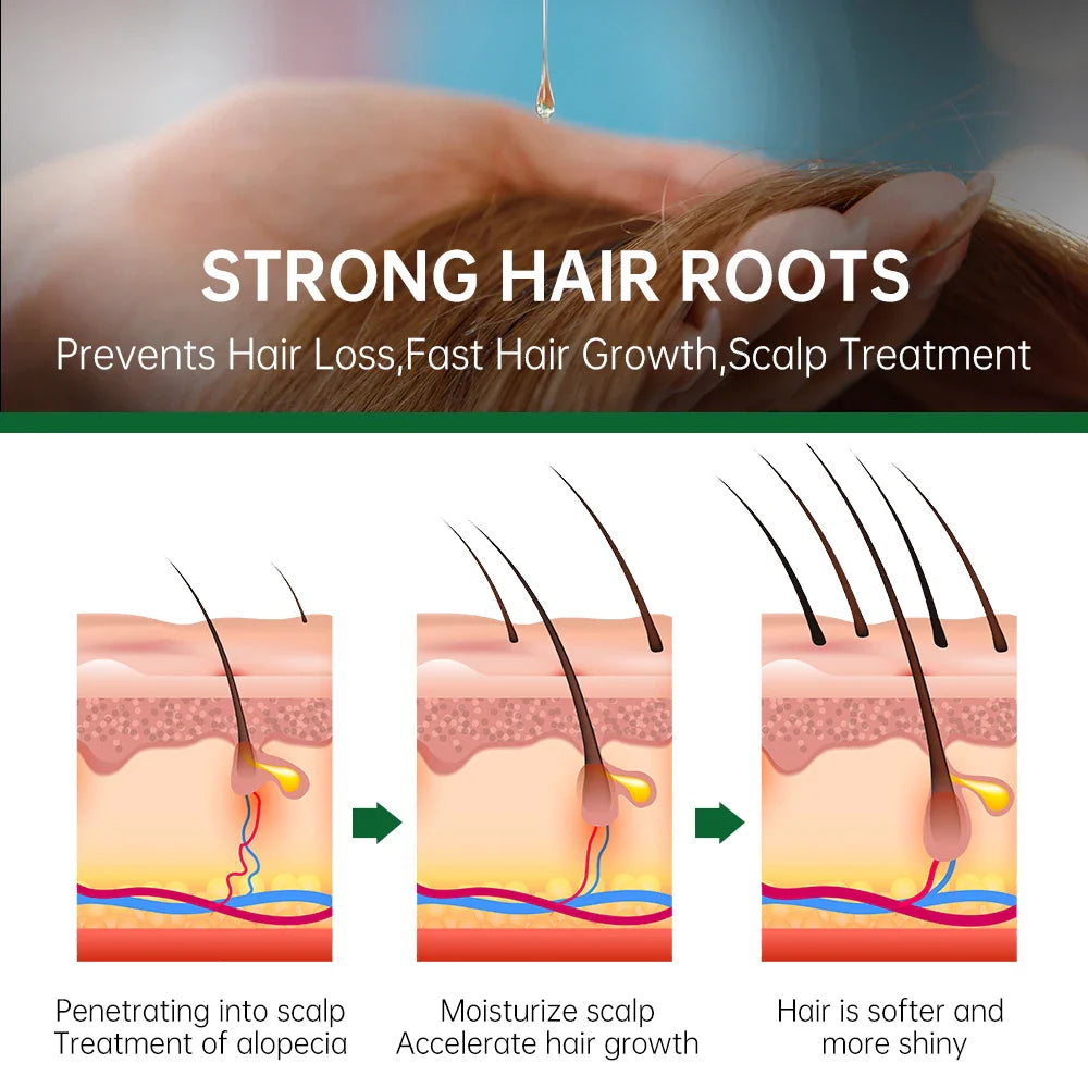 Rosemary Hair Growth Essential Oil - Wholesalus