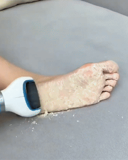 USB Foot Callus Remover Pedicure Tool - Wholesalus
