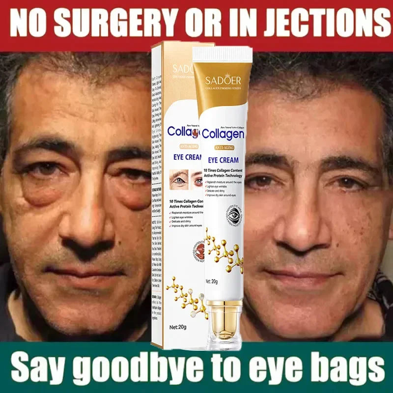 Instant Eye Bag Removal - Wholesalus