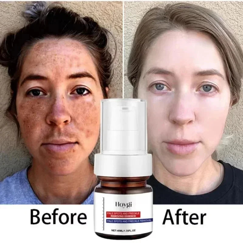 Moisturizing Dark Spots Remover - Wholesalus