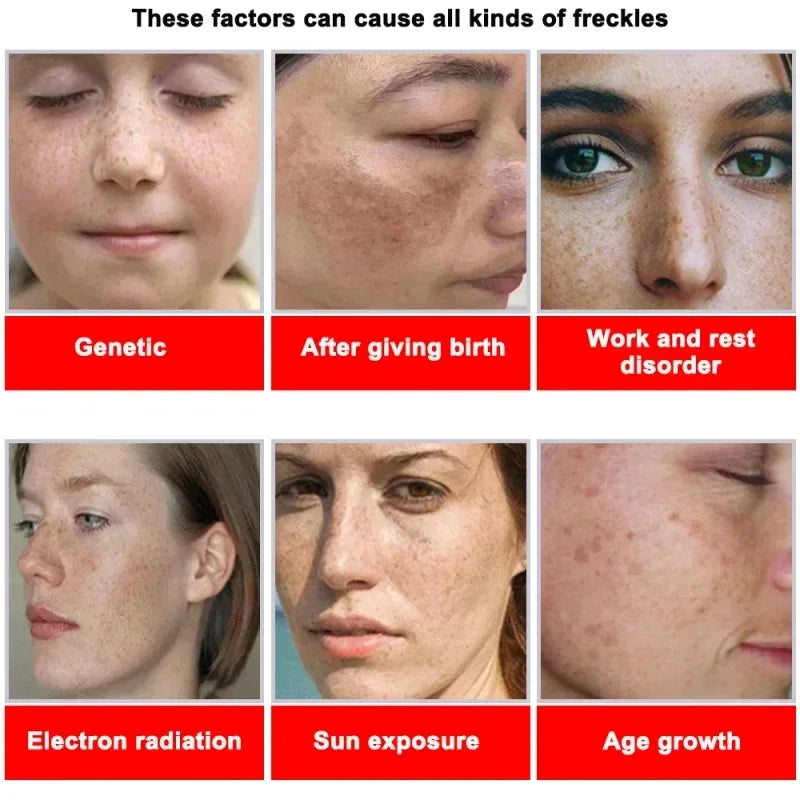 Moisturizing Dark Spots Remover - Wholesalus