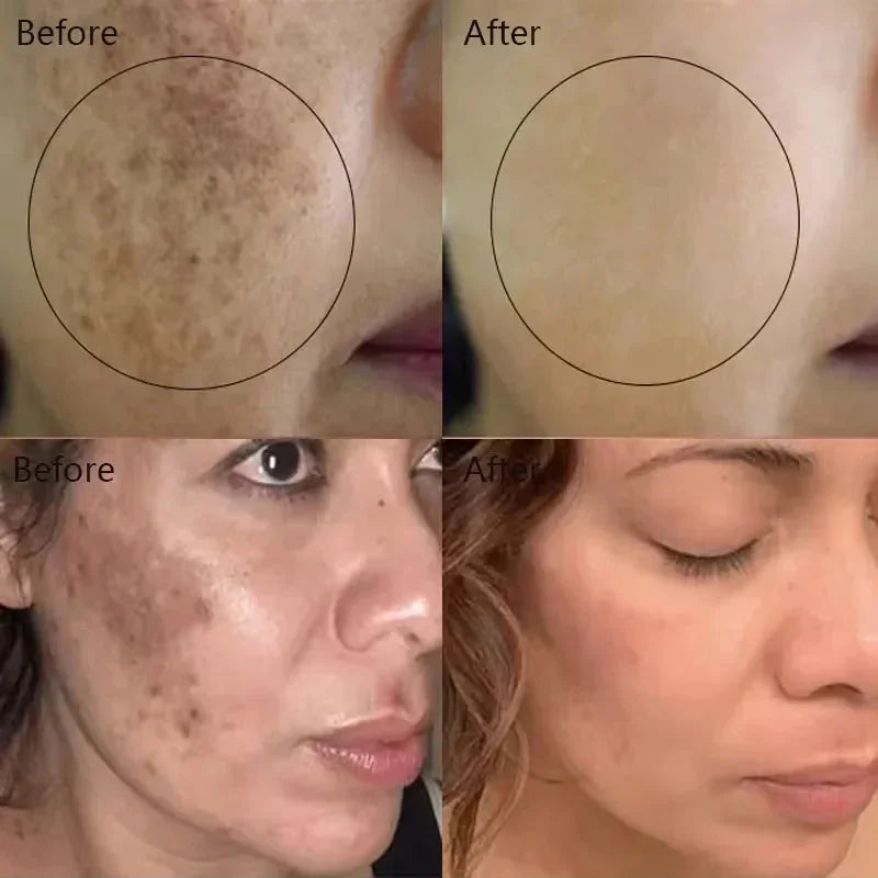 Moisturizing Dark Spots Remover - Wholesalus