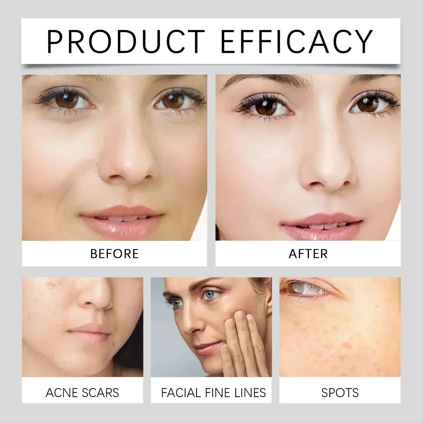 Moisturizing Dark Spots Remover - Wholesalus