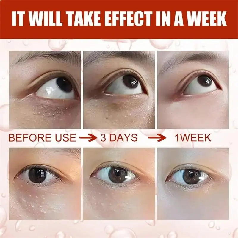 Under-Eye Granule Removal Serum - Wholesalus
