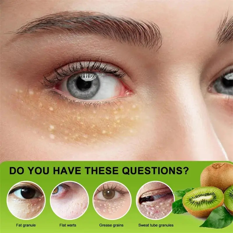 Under-Eye Granule Removal Serum - Wholesalus