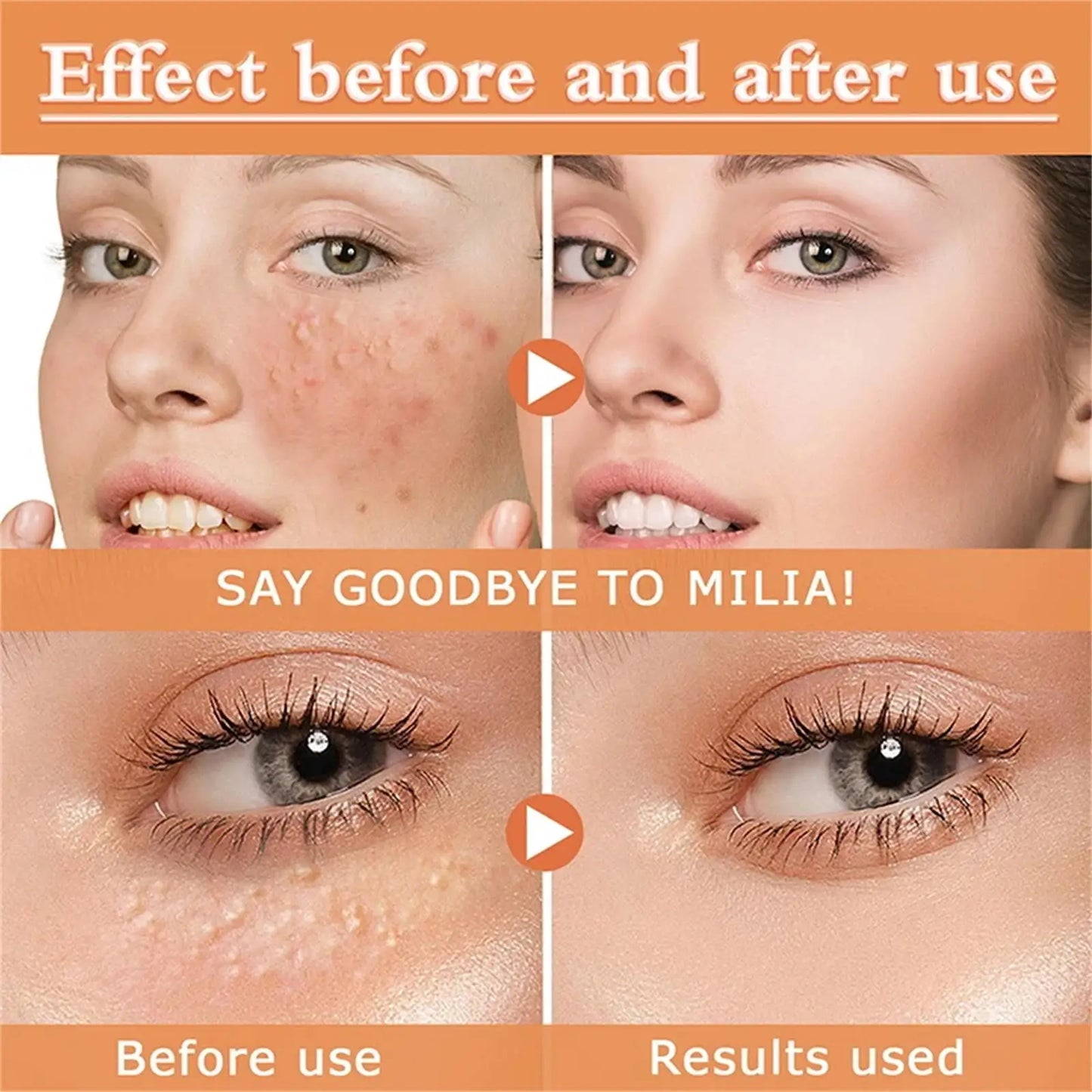 Under-Eye Granule Removal Serum - Wholesalus