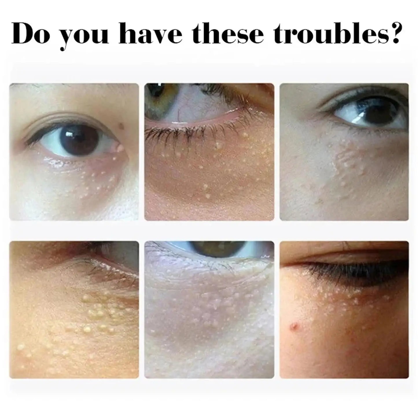 Under-Eye Granule Removal Serum - Wholesalus