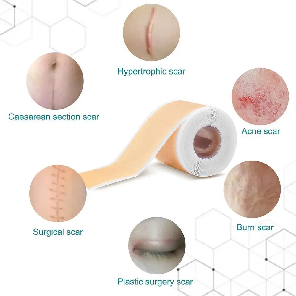 Silicone Gel Scar Repair Patch - Wholesalus