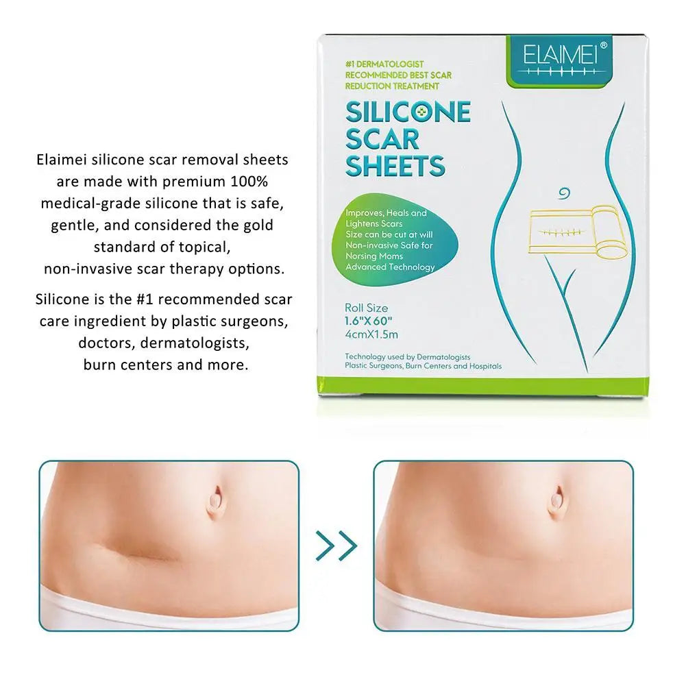 Silicone Gel Scar Repair Patch - Wholesalus