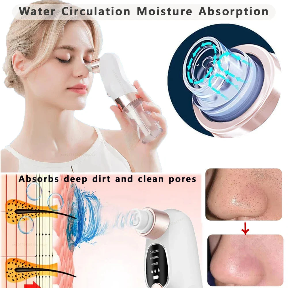 Acne Black Head Deep Clean Removal - Wholesalus