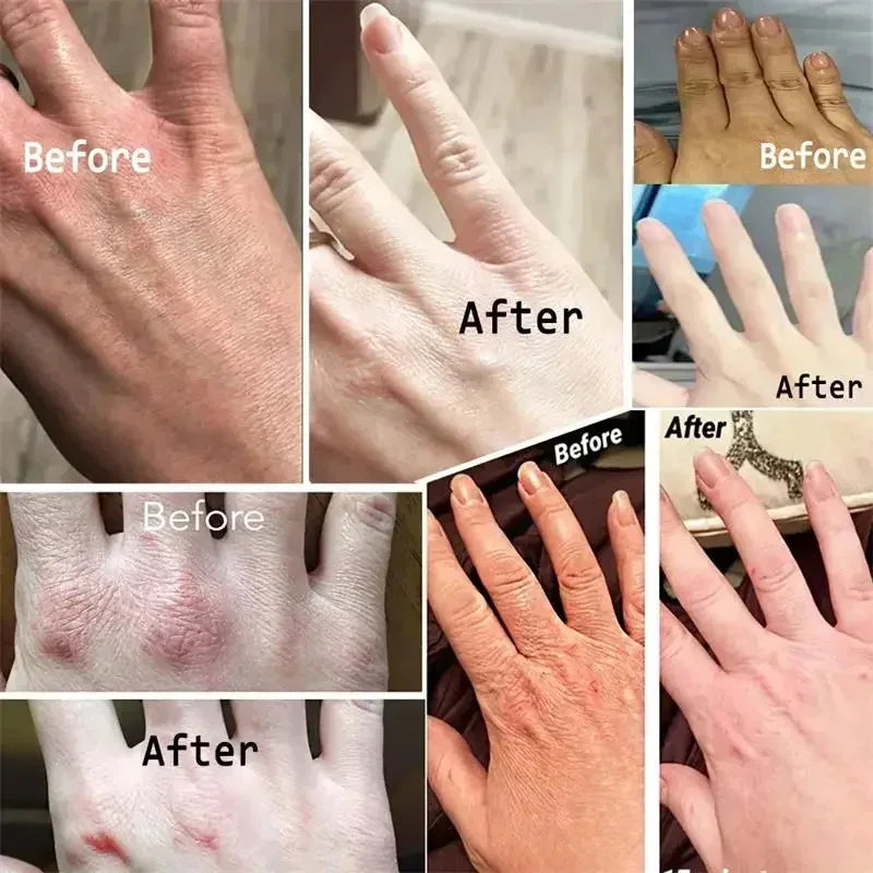 Anti-wrinkle Hand Cream - Wholesalus