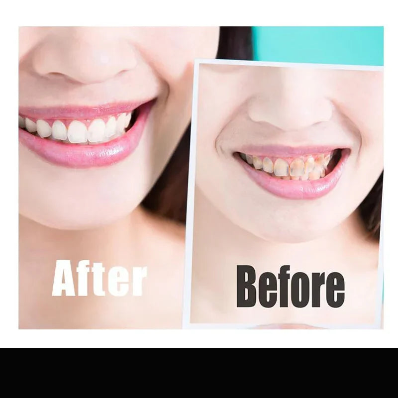 Charcoal Teeth Whitening Strips - 14 Pcs - Wholesalus