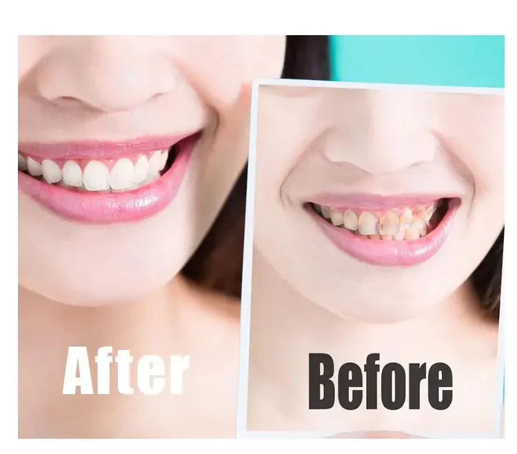 Charcoal Teeth Whitening Strips - 14 Pcs - Wholesalus