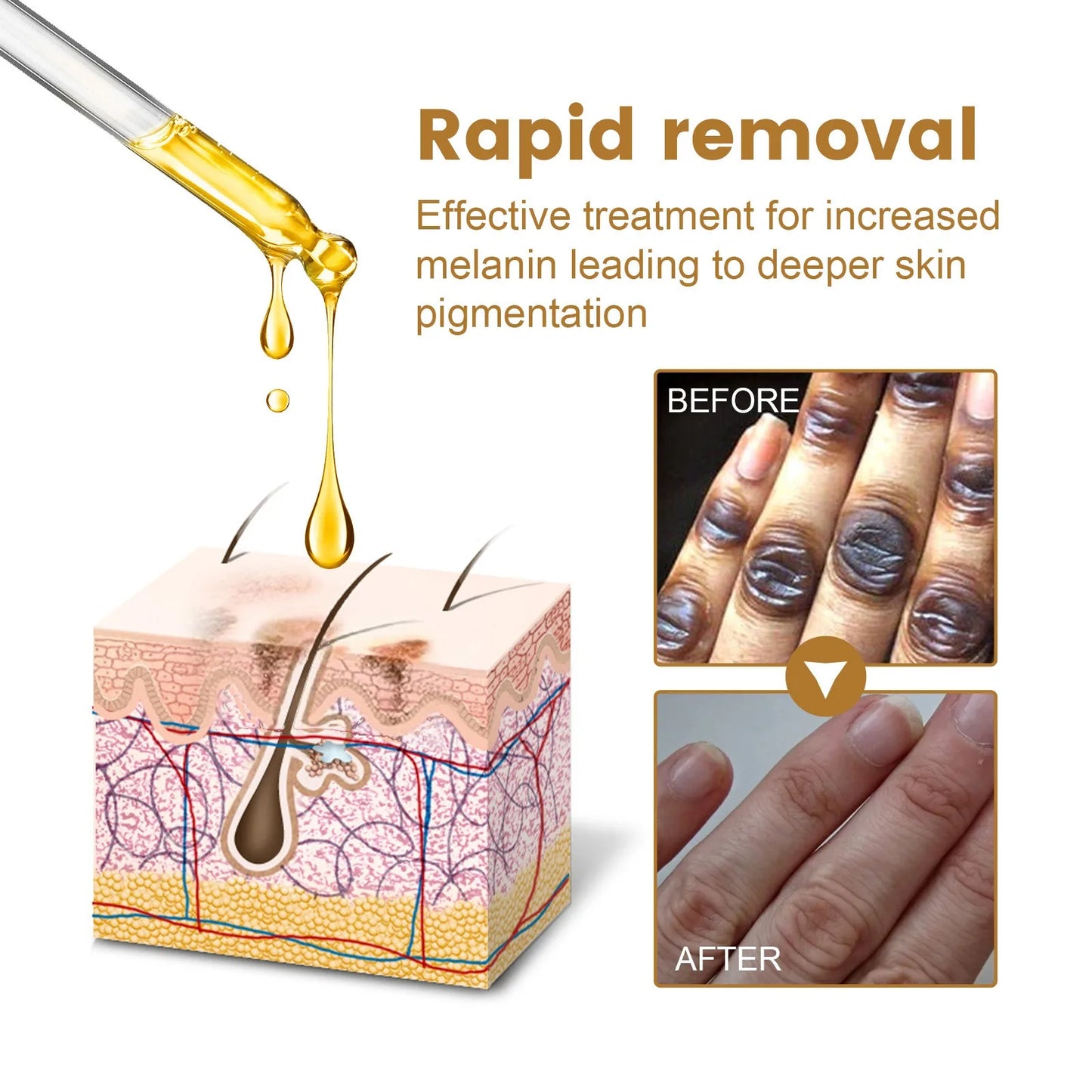 Dark Spot Removal Serum - Wholesalus