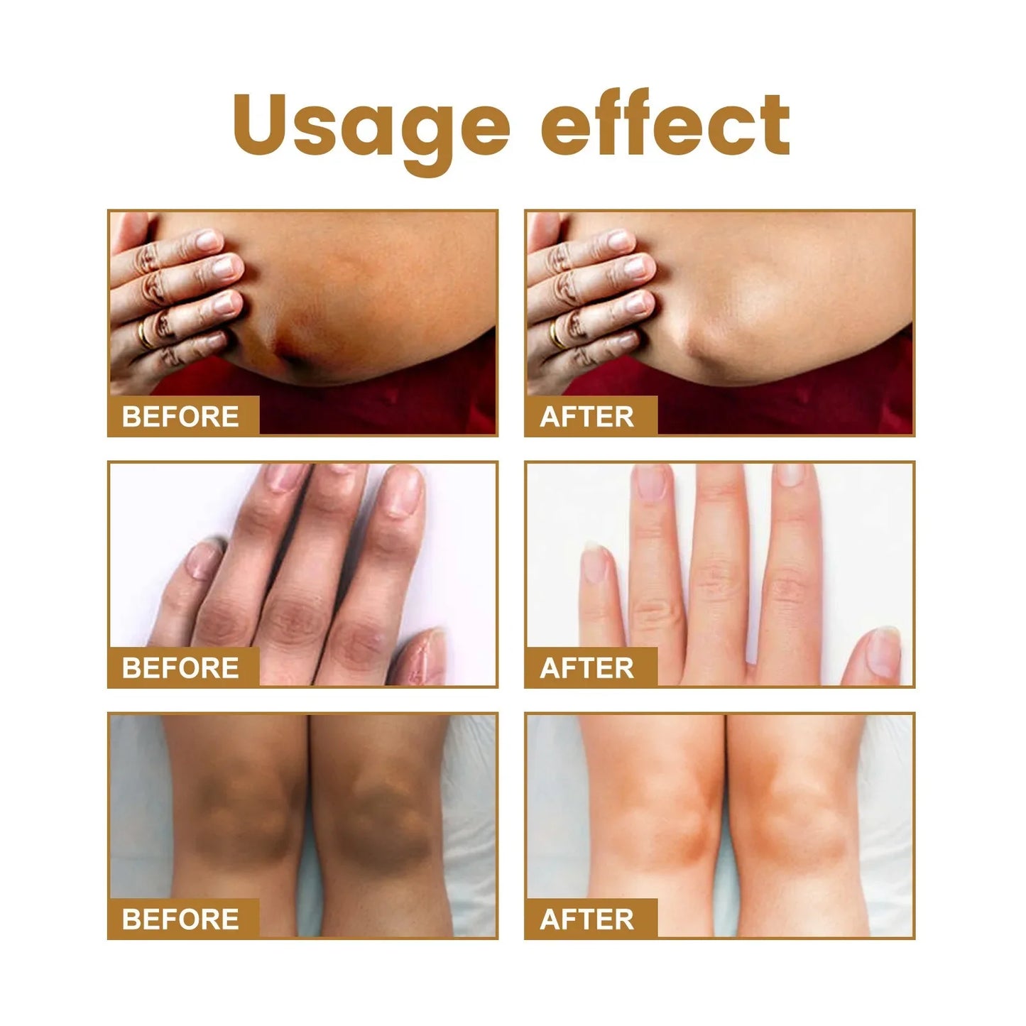 Dark Spot Removal Serum - Wholesalus