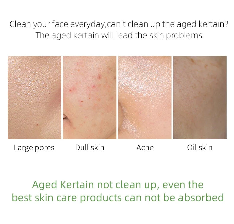 Exfoliating Gel for Whitening Face and Body Skin - Wholesalus