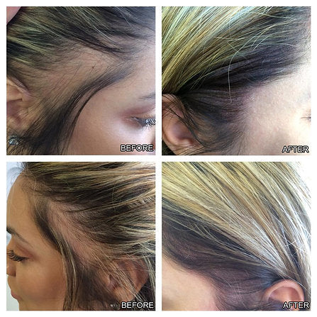 Hairline Rejuvenator Elixir - Wholesalus
