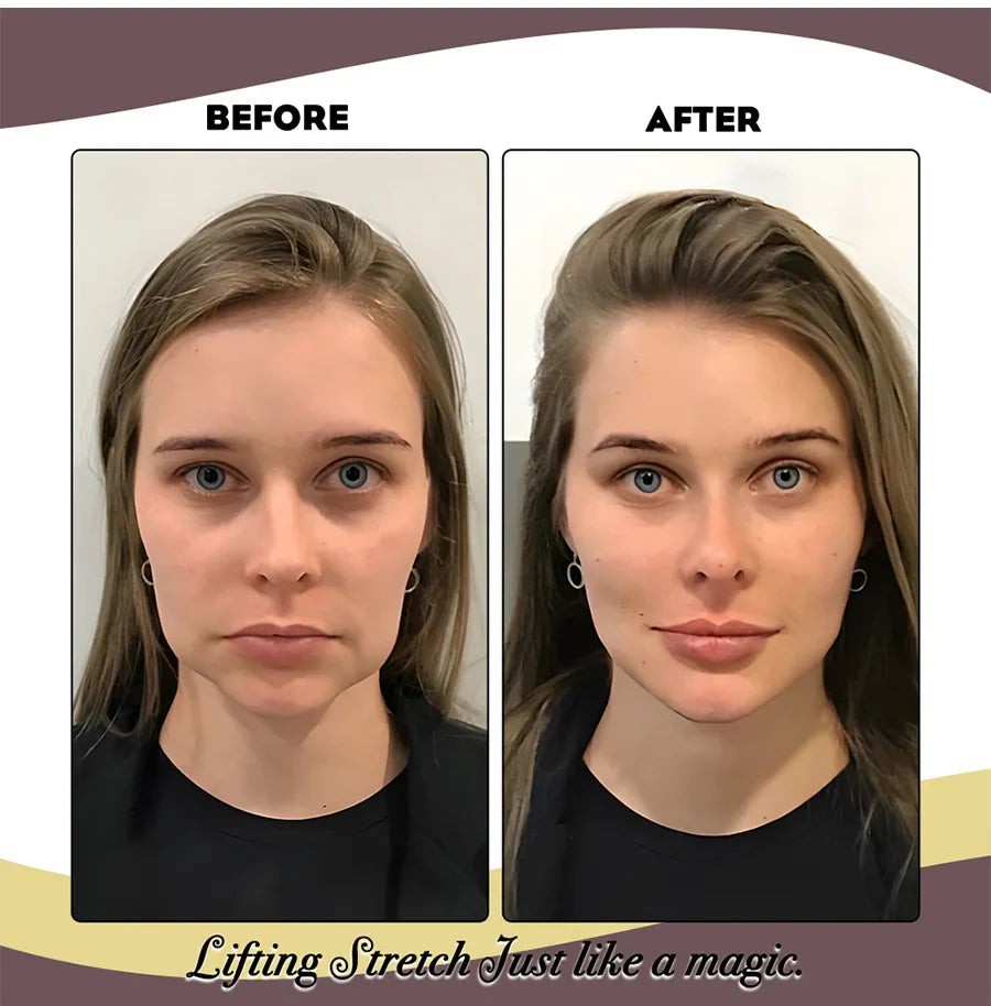 Elastic Face Lifting Band - Wholesalus