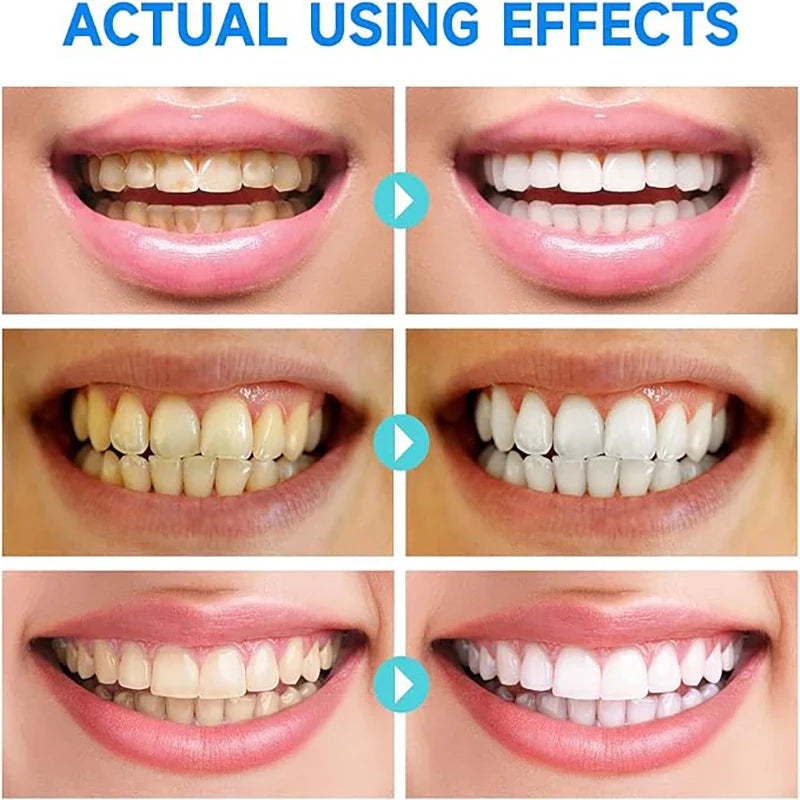 Herbal Stain Removal Whitening Toothpaste - Wholesalus