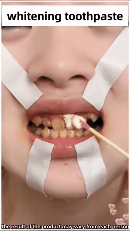 Dental Calculus Removing Toothpaste - Wholesalus