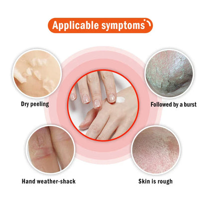 Dead Skin Remover Crack Cream - Wholesalus
