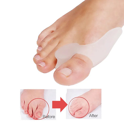 Silicone Toes Valgus Corrector - Wholesalus