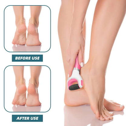 USB Foot Callus Remover Pedicure Tool - Wholesalus
