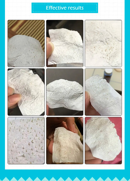 Nose Pore Strip Blackhead Remover - Wholesalus