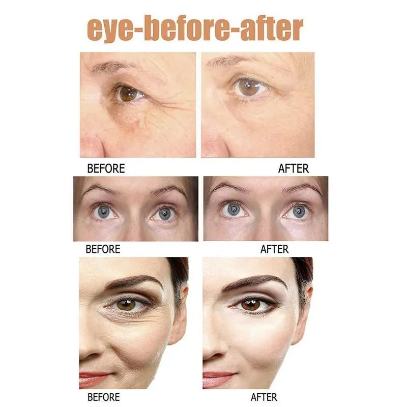 Instant Eye Bag Removal