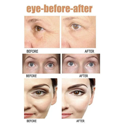 Instant Eye Bag Removal - Wholesalus