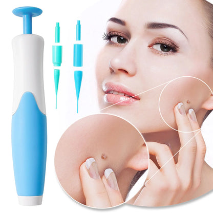 Skin Tag Removal Kit - Wholesalus