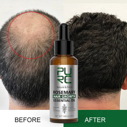 Rosemary Hair Growth Essential Oil - Wholesalus