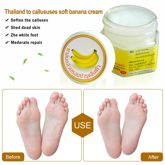 Dead Skin Remover Crack Cream - Wholesalus